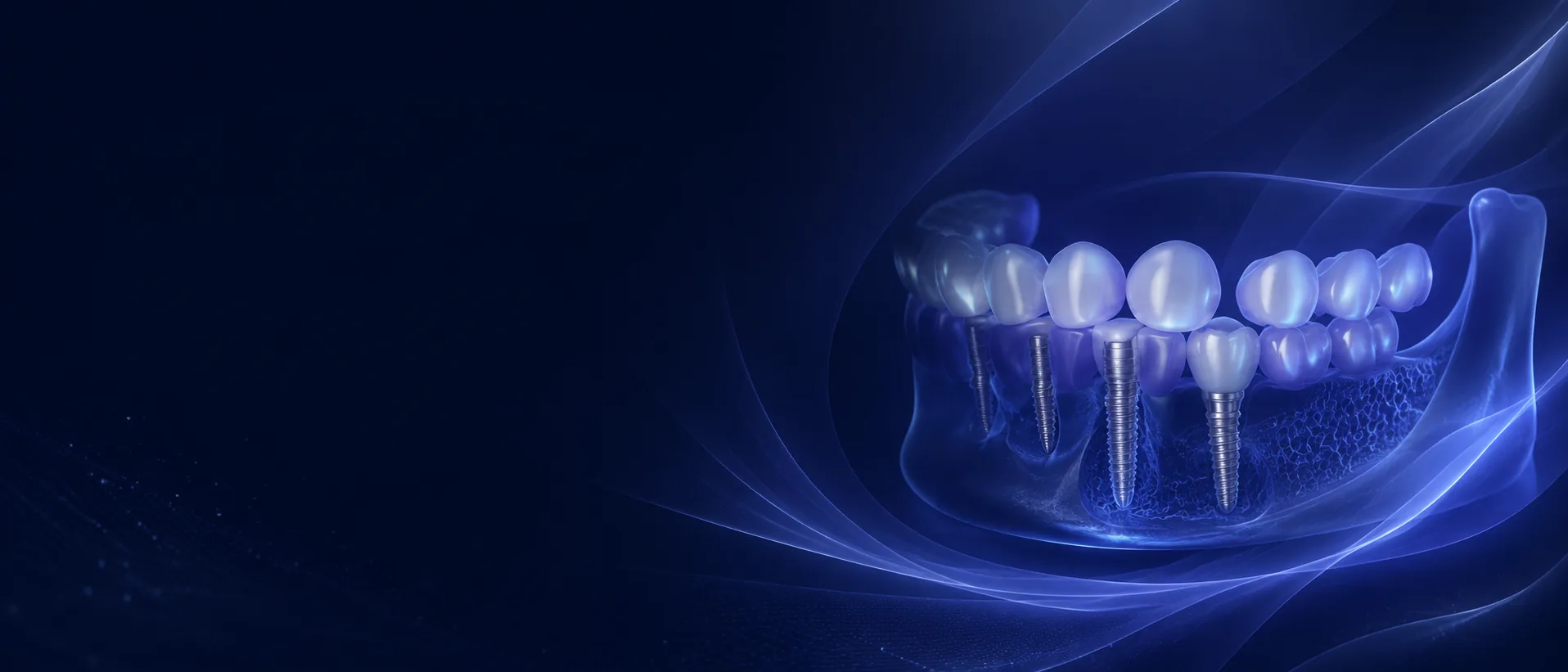 Fixed implant teeth consultation visual