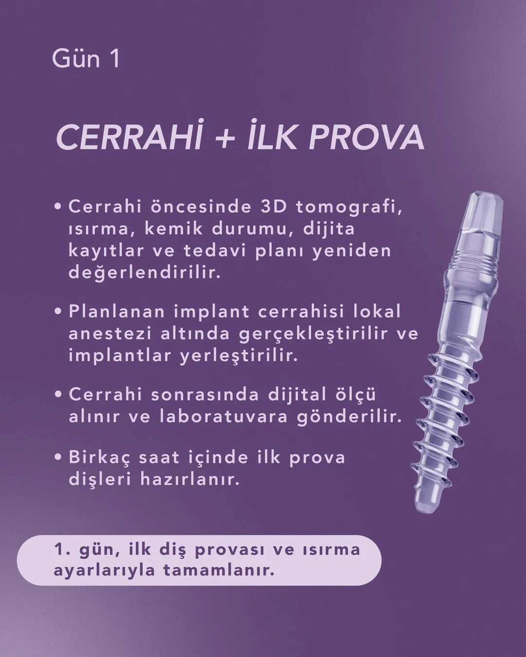1. gün, cerrahi ve ilk prova: 3D tomografi ve planın yeniden değerlendirilmesi, lokal anestezi altında implantların yerleştirilmesi, dijital ölçü ve birkaç saat içinde ilk dişlerin hazırlanması.