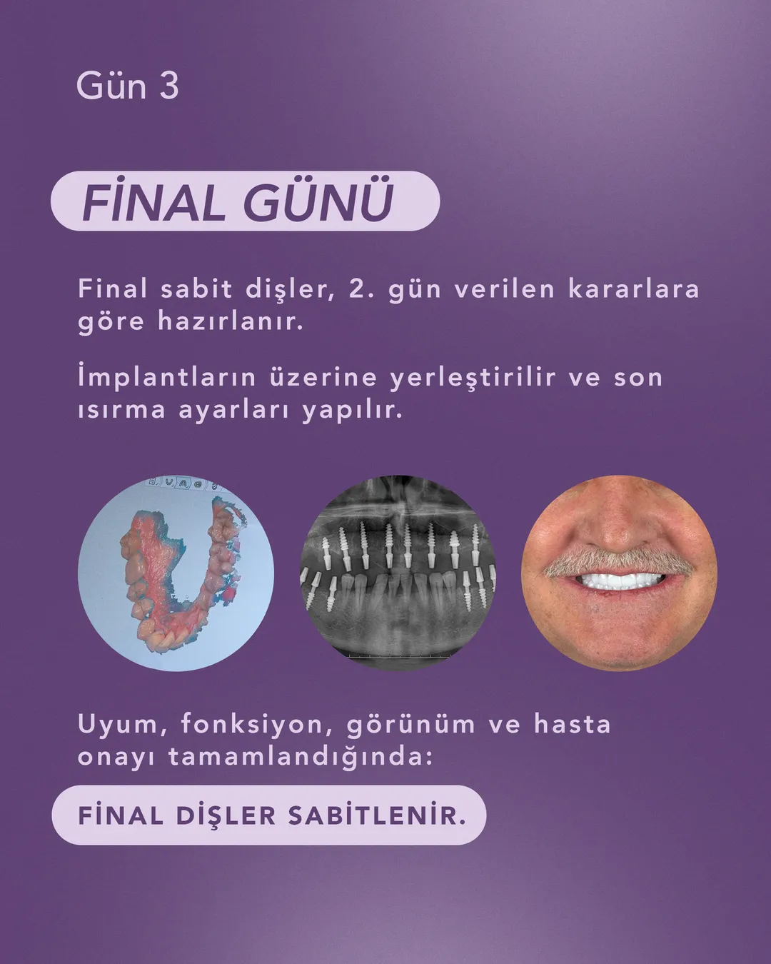 Fixed teeth delivery patient visual