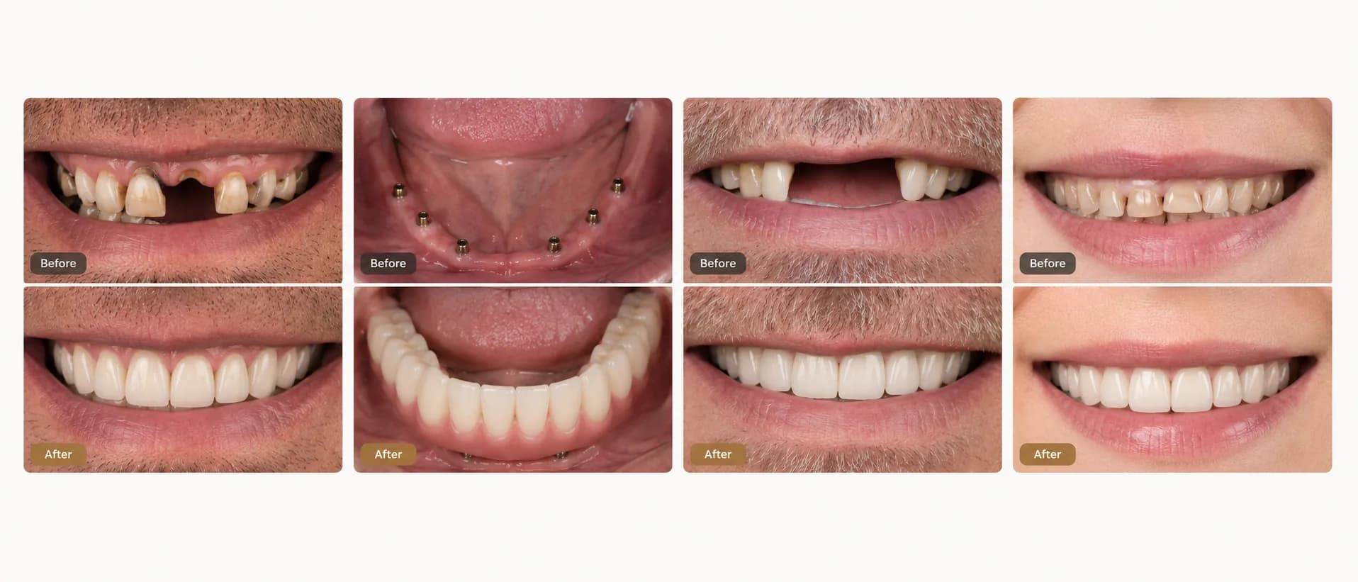 Before and after smile transformation examples